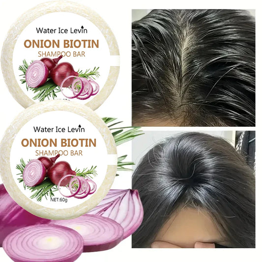 Onion & Biotin Shampoo Bar with Rosemary – Moisturizing Hair Soap for All Hair Types