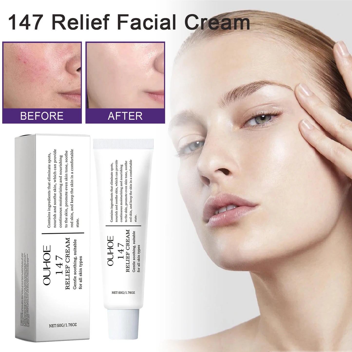 147 Relief Korean Skin Cream – Nourishing Moisturizer for Blemishes & Antioxidant Care